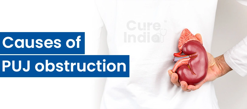 Causes of PUJ Obstruction